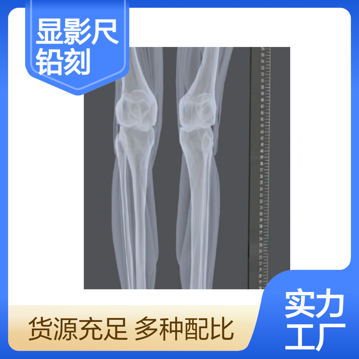 X射线标记显影尺铅刻度尺放射质控卫生质控检测铅尺X射线铅尺