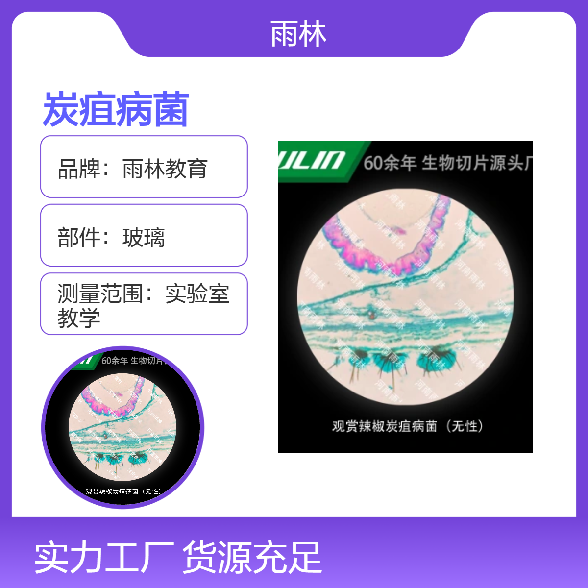 观赏辣椒炭疽病菌（无性）标本切片生物细胞观察实验高校教学示范
